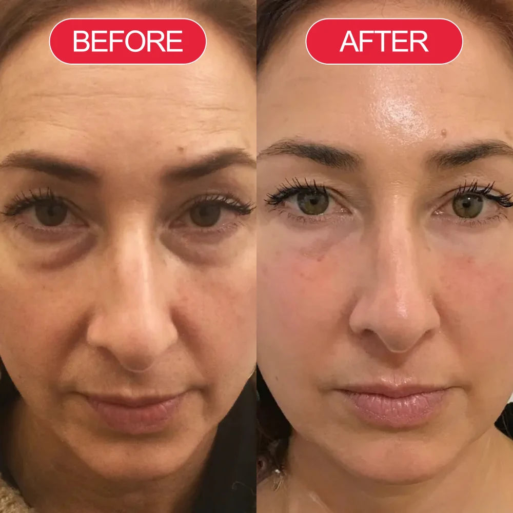 Catherine R. — image supplied on Koriderm's product page