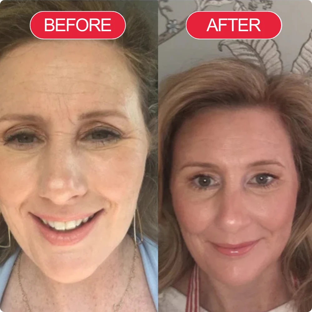 Linda M. — image supplied on Koriderm's product page